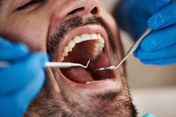 Best Emergency Care for Gum Disease in Nanticoke, PA